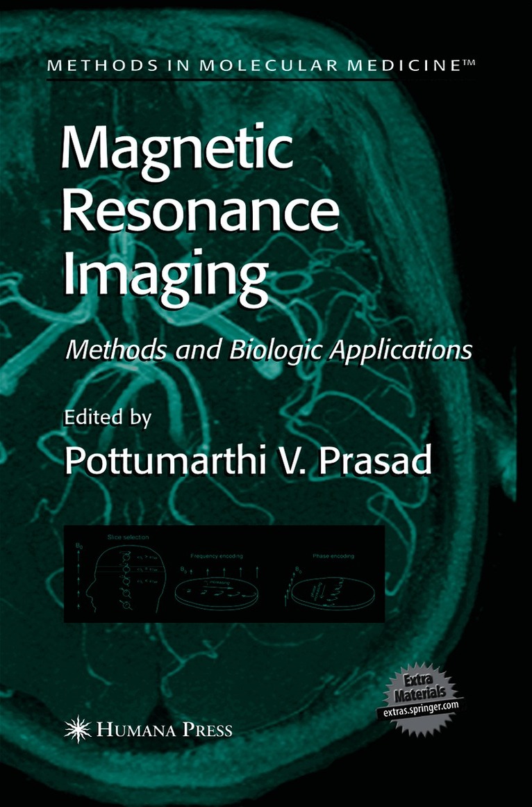 Magnetic Resonance Imaging
