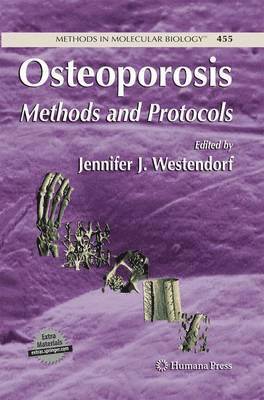 bokomslag Osteoporosis