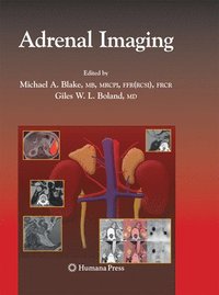 bokomslag Adrenal Imaging