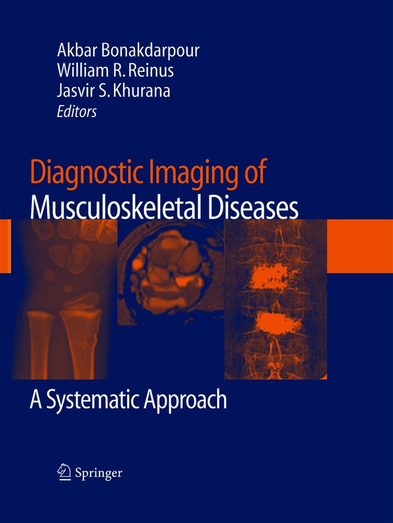 Diagnostic Imaging of Musculoskeletal Diseases