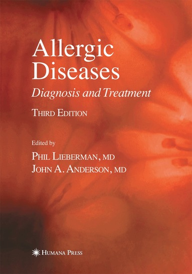 Phil Lieberman, John A. Anderson - Allergic Diseases, Häftad