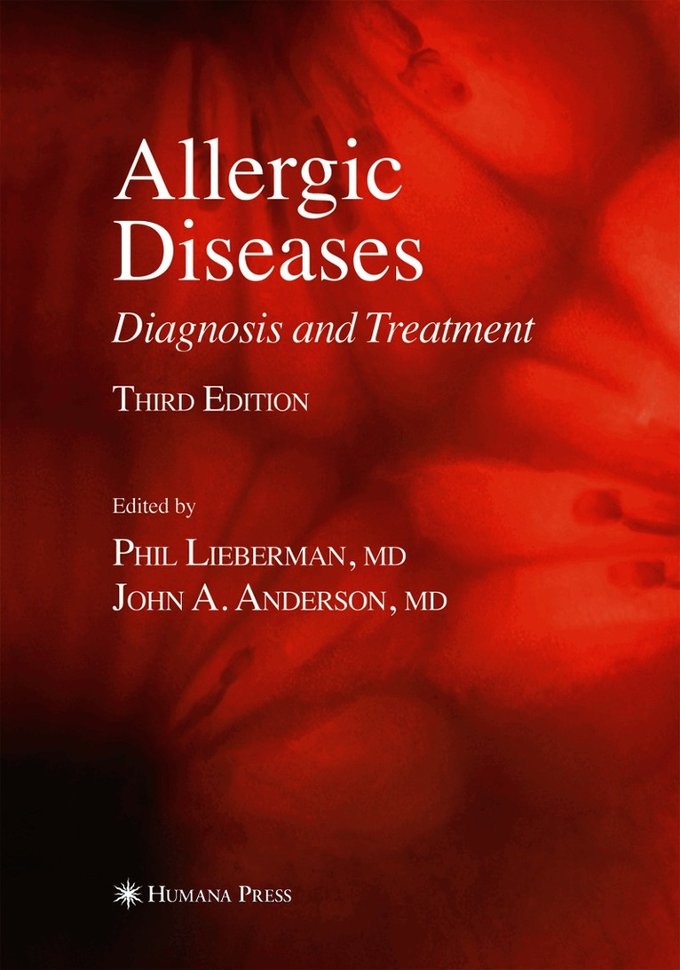 Allergic Diseases