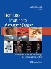 bokomslag From Local Invasion to Metastatic Cancer