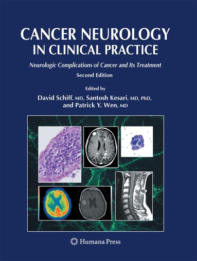 David Schiff, Santosh Kesari, Patrick C. Y. Wen - Cancer Neurology in Clinical Practice, Häftad