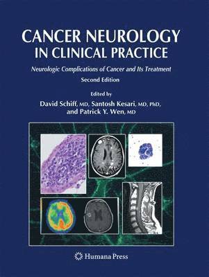 bokomslag Cancer Neurology in Clinical Practice