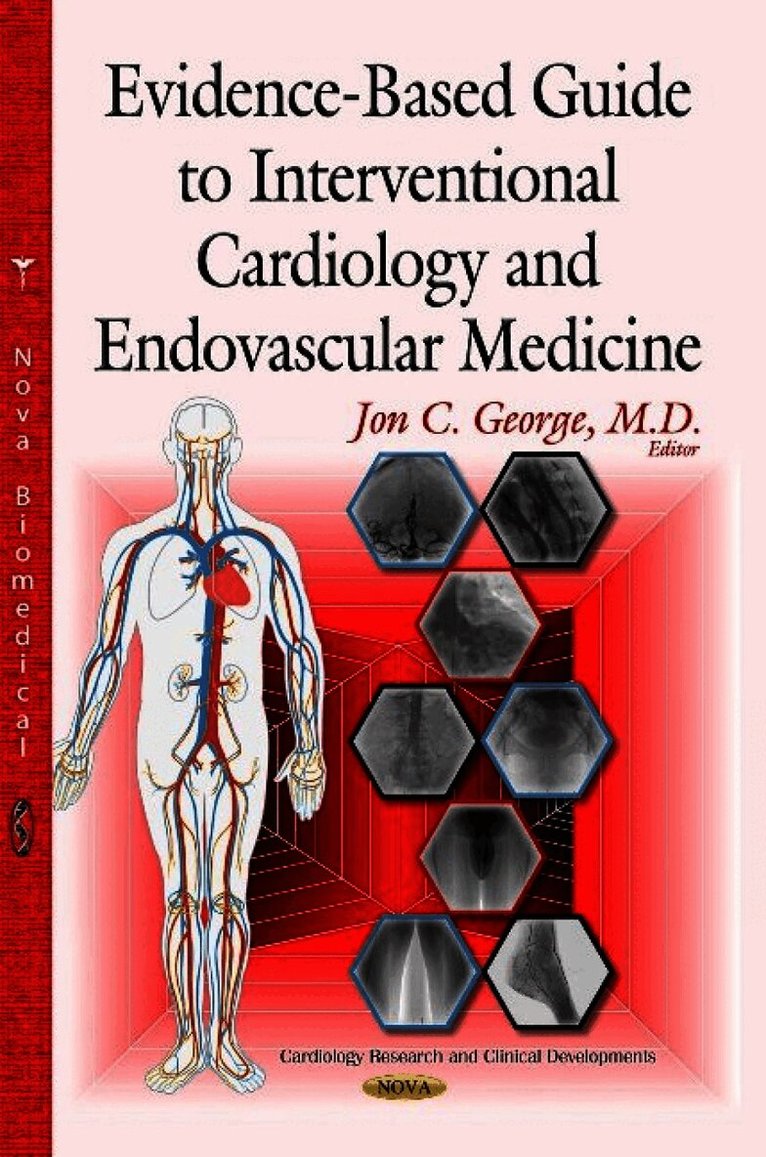 Evidence-Based Guide to Interventional Cardiology & Endovascular Medicine