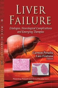 bokomslag Liver Failure