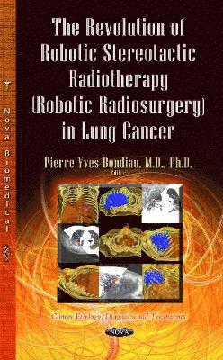 bokomslag Revolution of Robotic Stereotactic Radiotherapy (Robotic Radiosurgery) in Lung Cancer
