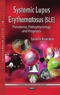 bokomslag Systemic Lupus Erythematosus (SLE)