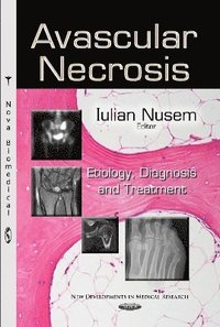bokomslag Avascular Necrosis