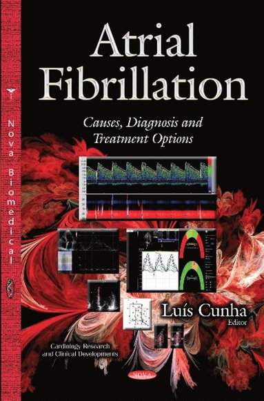 bokomslag Atrial Fibrillation