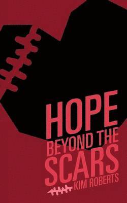 bokomslag Hope Beyond the Scars