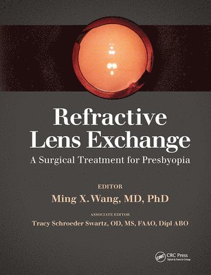 bokomslag Refractive Lens Exchange