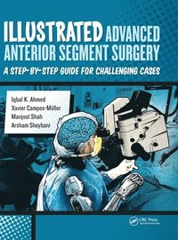 bokomslag Illustrated Advanced Anterior Segment Surgery