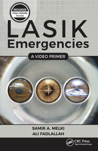 bokomslag LASIK Emergencies: A Video Primer