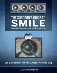 bokomslag The Surgeon's Guide to SMILE