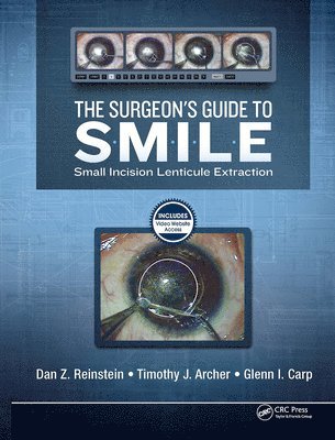 bokomslag The Surgeons Guide to SMILE