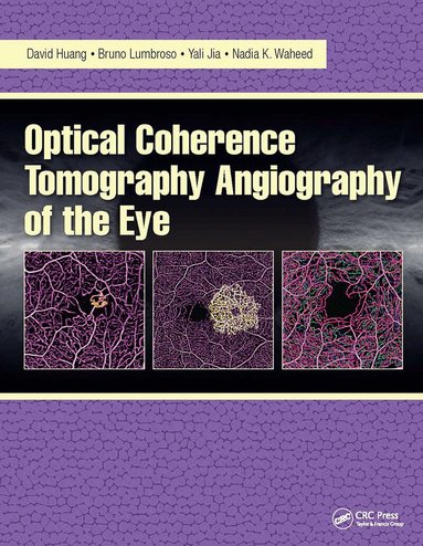 David Huang, Bruno Lumbroso, Yali Jia, Nadia Waheed - Optical Coherence Tomography Angiography of the Eye, Häftad