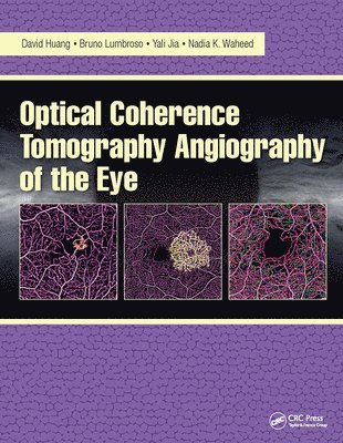 Optical Coherence Tomography Angiography of the Eye 1