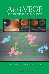 bokomslag Anti-VEGF Use in Ophthalmology