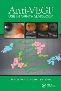 bokomslag Anti-VEGF Use in Ophthalmology