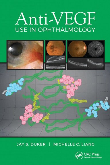 Jay Duker, Michelle Liang - Anti-VEGF Use in Ophthalmology, Häftad