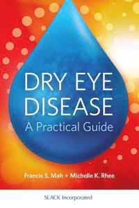 bokomslag Dry Eye Disease