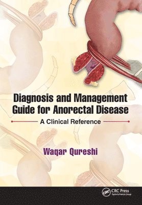 bokomslag Diagnosis and Management Guide for Anorectal Disease