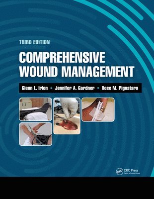 Glenn Irion, Jennifer Gardner, Rose Pignataro - Comprehensive Wound Management, Inbunden