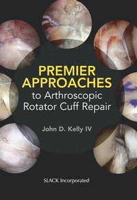 bokomslag Premier Approaches to Arthroscopic Rotator Cuff Repair