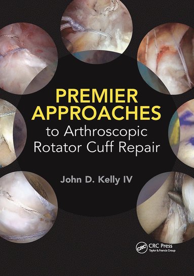 bokomslag Premier Approaches to Arthroscopic Rotator Cuff Repair