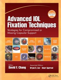 bokomslag Advanced IOL Fixation Techniques