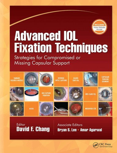 David F. Chang - Advanced IOL Fixation Techniques, Inbunden