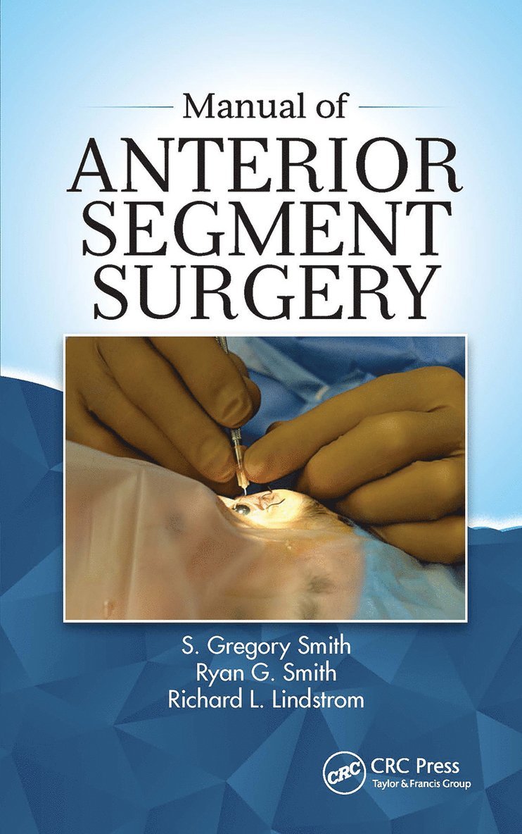 Manual of Anterior Segment Surgery 1