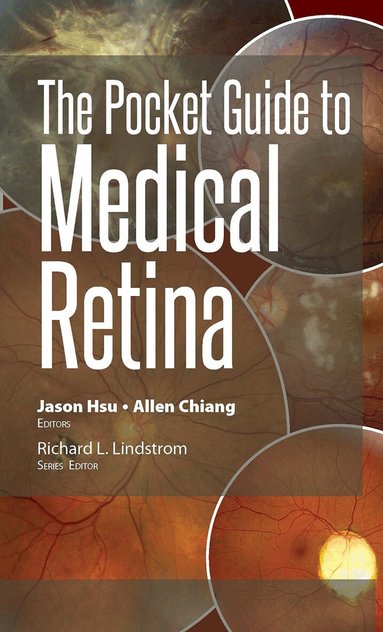 Jason Hsu, Allen Chiang - Pocket Guide to Medical Retina, Häftad