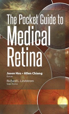 The Pocket Guide to Medical Retina 1