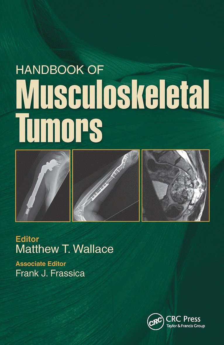 Handbook of Musculoskeletal Tumors