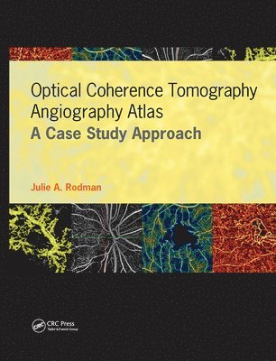 Julie Rodman, Dan Esmaili - Optical Coherence Tomography Angiography Atlas, Inbunden