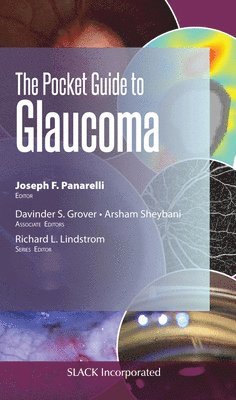 Pocket Guide to Glaucoma