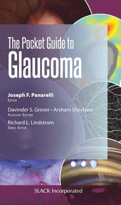 The Pocket Guide to Glaucoma 1