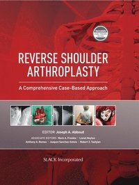 bokomslag Reverse Shoulder Arthroplasty