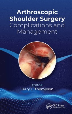 Terry Thompson - Arthroscopic Shoulder Surgery, Häftad