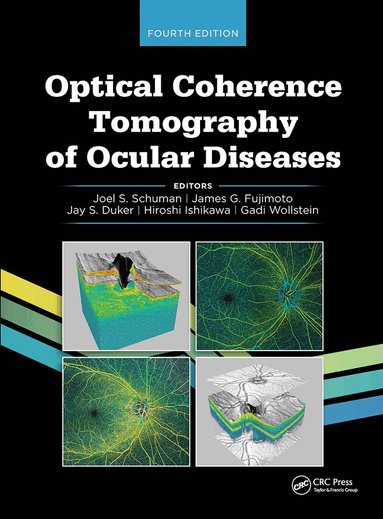 Joel S. Schuman, James G. Fujimoto, Jay Duker, Hiroshi Ishikawa - Optical Coherence Tomography of Ocular Diseases, Inbunden