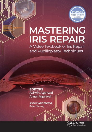 Ashvin Agarwal, Amar Agarwal - Mastering Iris Repair, Häftad
