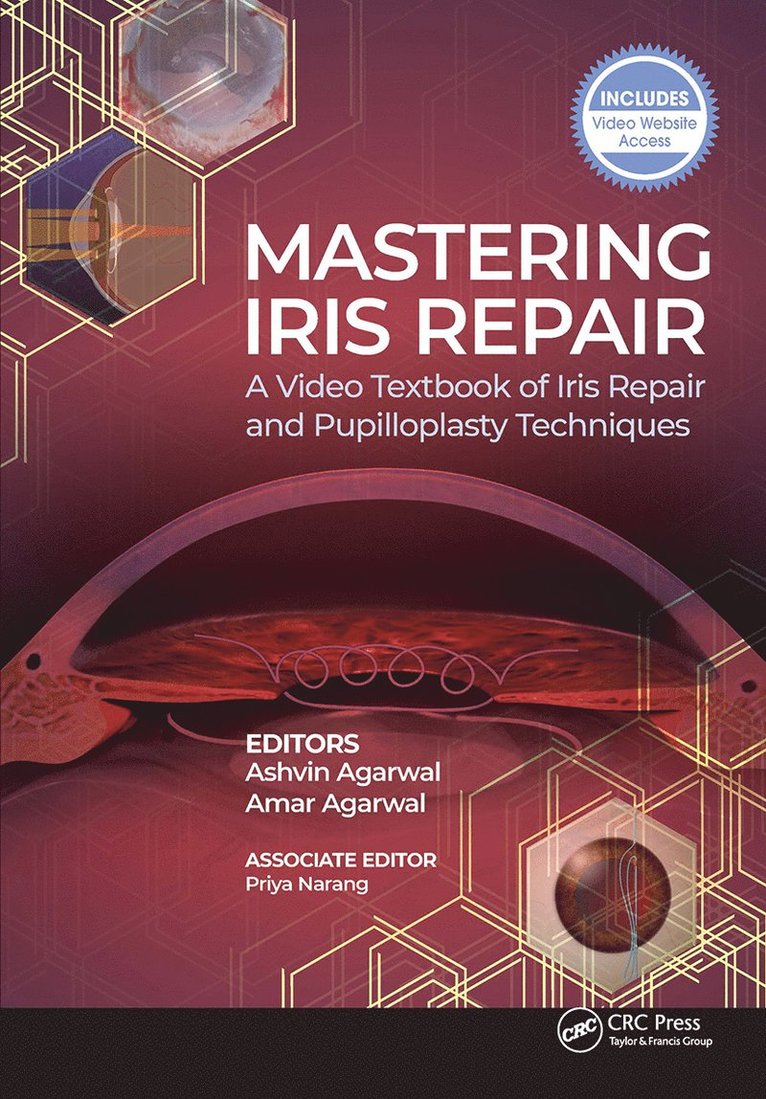 Mastering Iris Repair