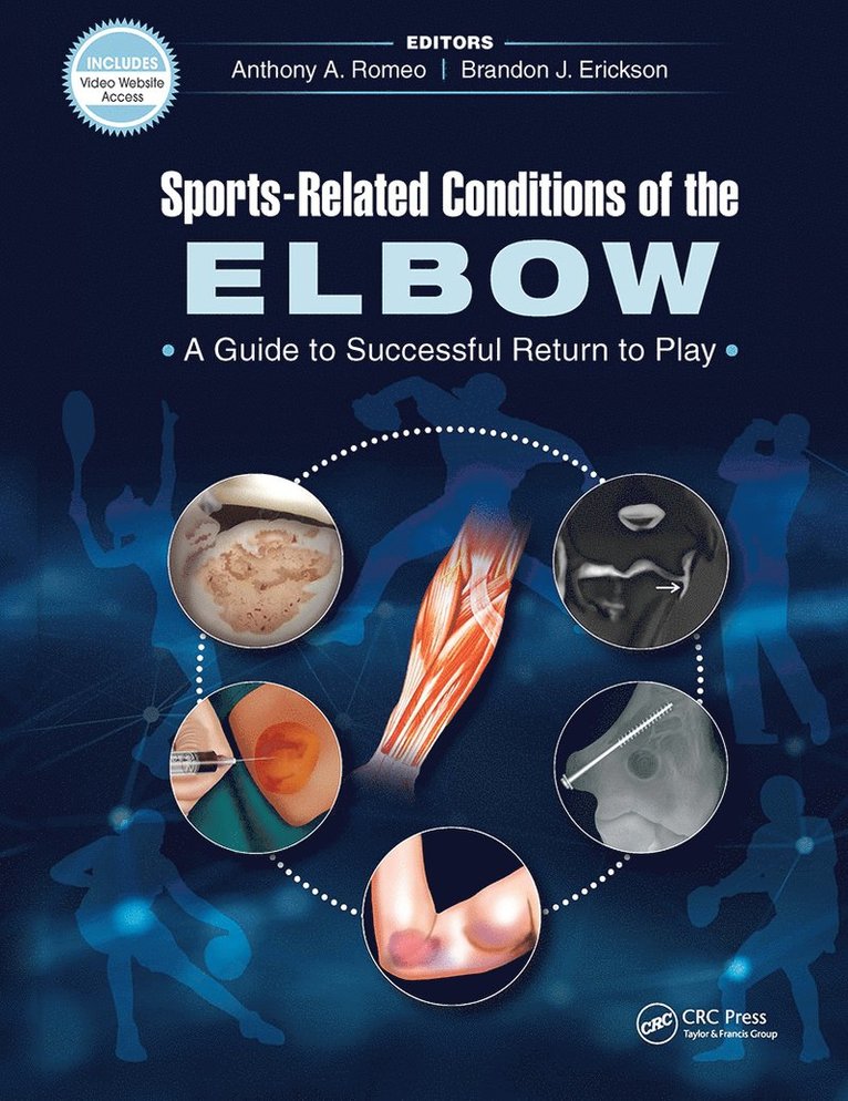 Anthony Romeo, Brandon Erickson - Sports-Related Conditions of the Elbow, Inbunden