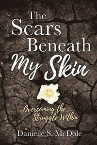 bokomslag The Scars Beneath My Skin