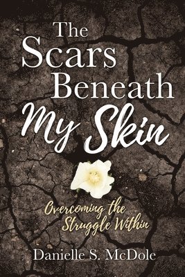 The Scars Beneath My Skin 1