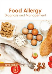 bokomslag Food Allergy: Diagnosis and Management