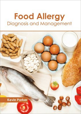 Food Allergy: Diagnosis and Management 1